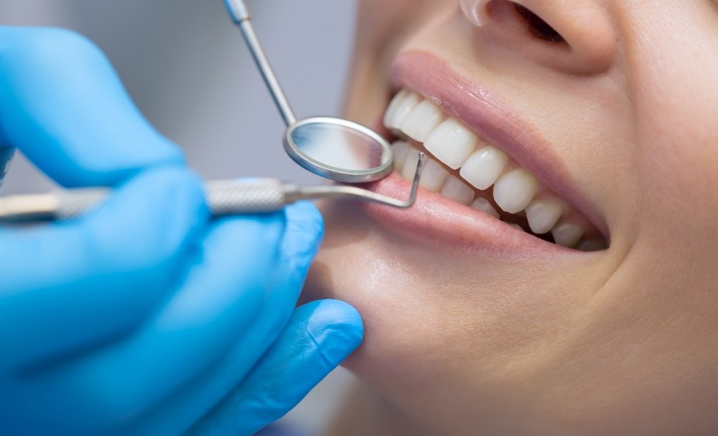 Close up of person having their teeth examined by dentist