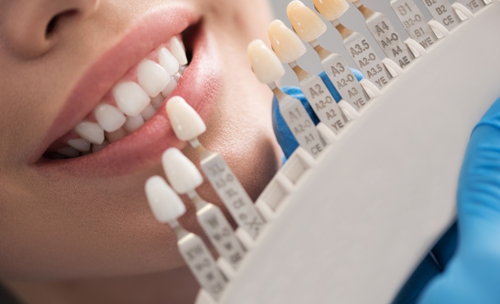 Close up of dentist holding shade guide to a smiling patient