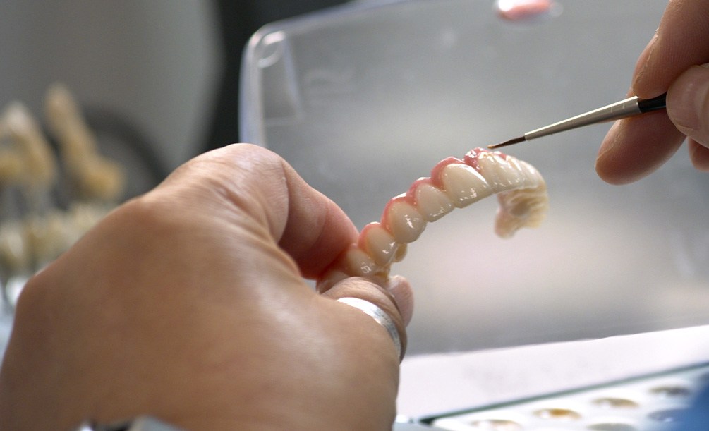 Upper Hybridge denture against black background