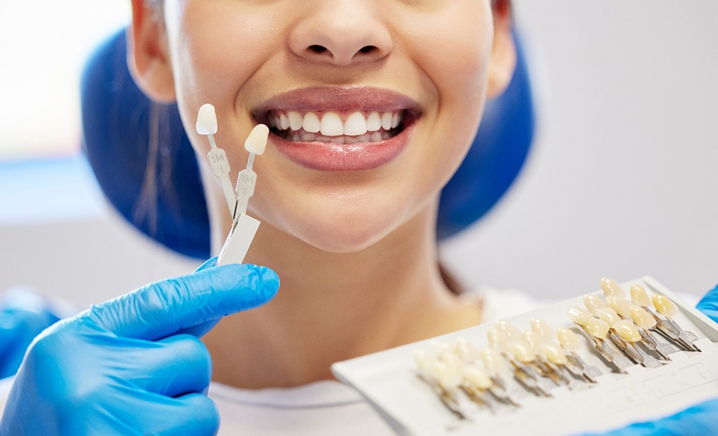 Gloved hands holding shade guide to woman’s smile
