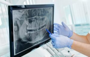 Dental X-ray pictured. 